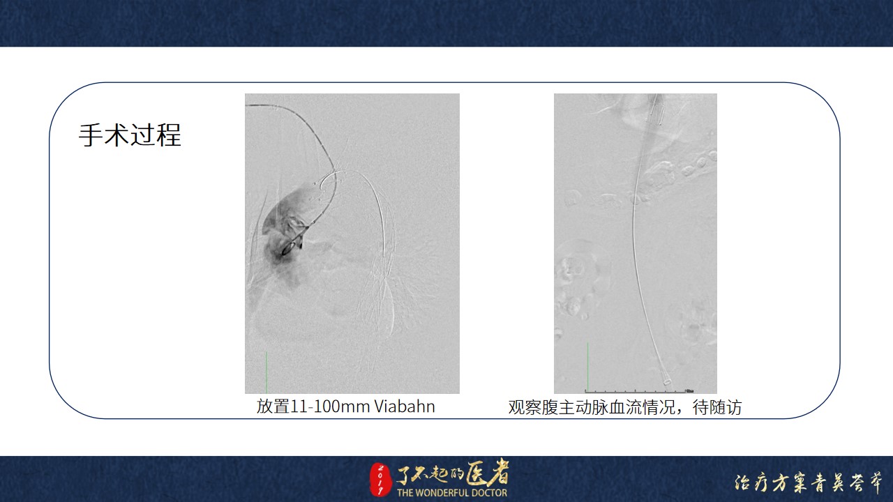 幻灯片14.jpg