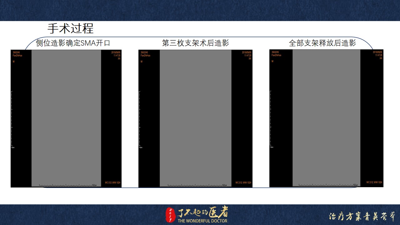 幻灯片9.jpg