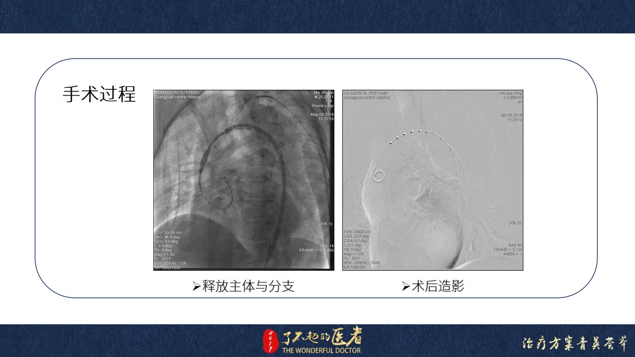 幻灯片17.jpg