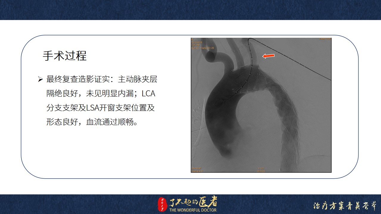 幻灯片11.jpg