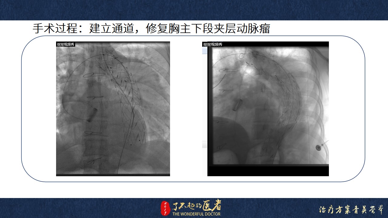 幻灯片12.jpg