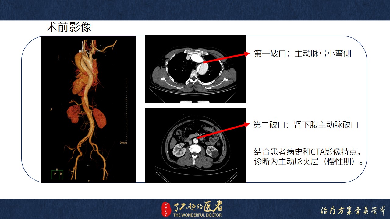 幻灯片3.jpg