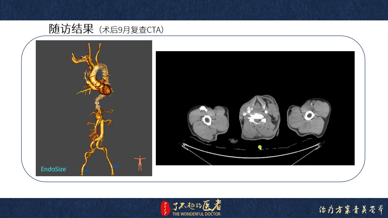 幻灯片14.jpg