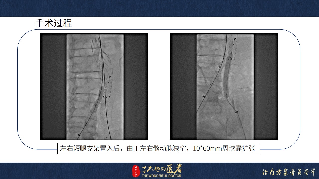 幻灯片13.jpg