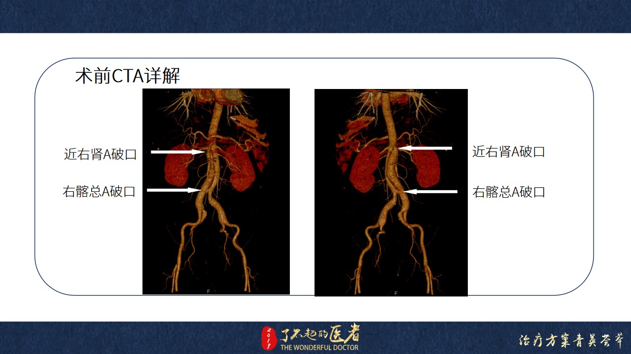 幻灯片6.jpg