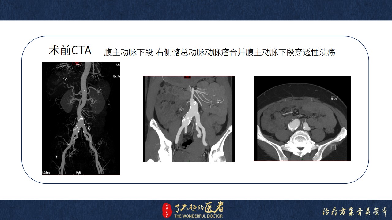 幻灯片3.jpg