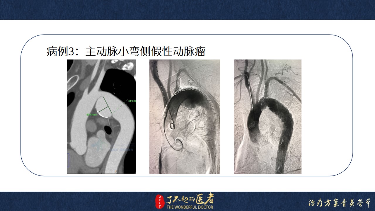 幻灯片18.jpg