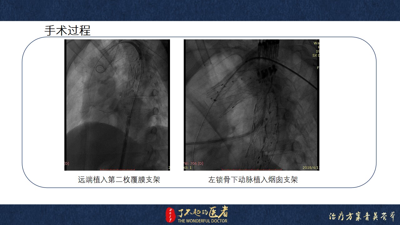 幻灯片11.jpg