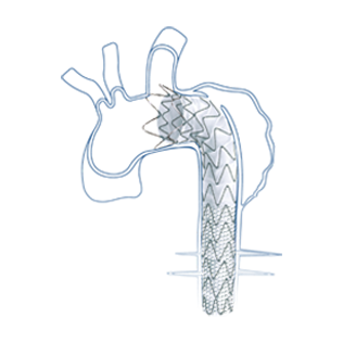 talos™ thoracic stent graft system